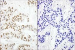 RPA2, p Ser4, p Ser8 Antibody, Novus Biologicals 0.1mL; Unlabeled:Antibodies,
